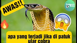 Apa yang terjadi jika kita dipatuk ular cobra!??. Tonton ini biar tau