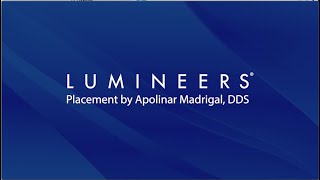 Time-Lapse Lumineers Placement by Apolinar Madrigal DDS | www.lumineers.com