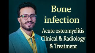 02 Bone infection: Acute osteomyelitis, Clinical & Radiology & Treatment