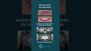 ESPECIALISTAS EN IMPLANTES