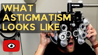 What Does Astigmatism Look Like?