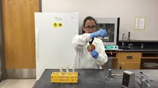 Gram positive and gram negative selected tests