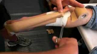 Achilles Tape application