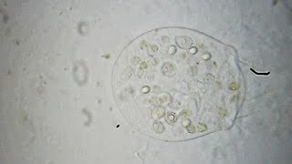 Vorticella - Pseudovorticella