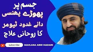 Dane Khatam Karne Ka | Ghadood phonsi ka rohani ilaj | Aurat Ki Rasoli Ka Ilaj Phoray Phunsi