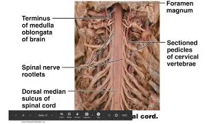 Virtual Spinal Cord Dissection