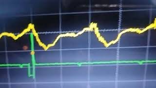 transdutor ultrassom nos bicos injetor muito bom