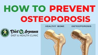 What is Osteoporosis, Reasons Behind it and Ways to Prevent it | #dietbyarpana #osteoporosis