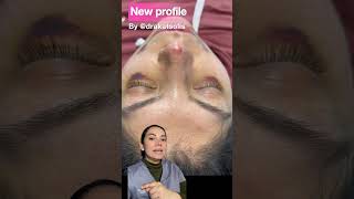 Perfilamiento facial