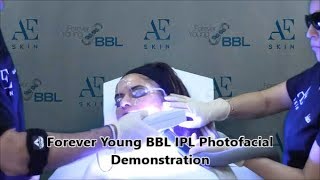 Forever Young BBL IPL Photofacial Demo 50 Noelia Ramirez - A E Skin - Encino, CA - 818-835-1833