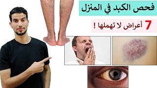 افحص كبدك في المنزل في دقائق _ انتبه لاعراض خطيرة تلزم الطبيب