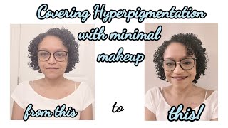 Covering hyperpigmentation with minimal makeup