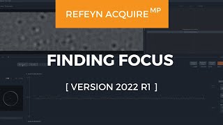 Refeyn AcquireMP (Version 2022 R1) | Finding Focus