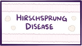 Hirschsprung disease