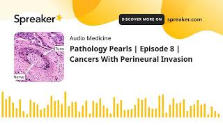 Cancers With Perineural Spread in Less than 1 Minute!