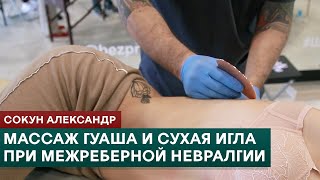 Массаж Гуаша и иглоукалывание при межреберной невралгии. Сокун Александр