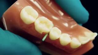 Class II Composite Restoration Tip by Dr. Dennis Hartlieb | DOTHANDSON