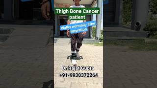 Bone Cancer Ewings Sarcoma thigh bone walks normally - ECRT technique@bonecancerclinic