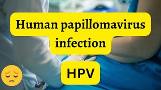 Understanding human papillomavirus infection HPV: The Most Common STI trending news