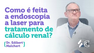 Como é feita a endoscopia a laser para tratamento de calculo renal? |  | Dr. Edibert Melchert