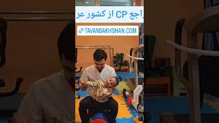 بهترین دکتر کاردرمانی در مشهد |کلینیک تخصصی توانبخشی نورولوژی کودکان و بزرگسالان در مشهد #shorts