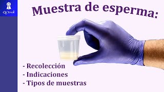 ¿Cuáles son las indicaciones para muestras de semen? Espermatobioscopía y espermocultivo