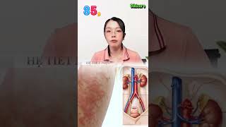 Mối quan hệ giữa sức khỏe và thân nhiệt |Vikicare #shorts