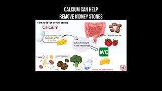 Calcium can help remove kidney stones #calcium #kidneystone #kidneydisease #kidneyhealth