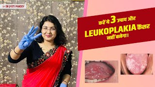 करें ये 3 उपाय और Leukoplakia कैंसर नहीं बनेगा। 100 प्रतिशत गारंटी ||