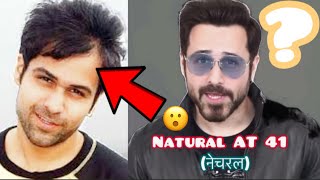 Emraan hashmi|hair transplant| Results| Minoxidil| Finasteride| hair fall| hindi| hairstyle|regrowth