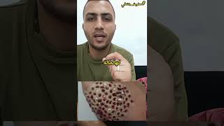 شوف إنت عندك فوبيا أو لا