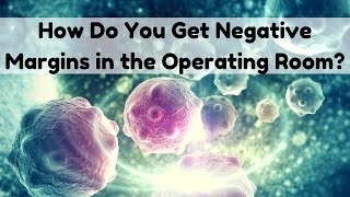 How Do You Get Negative Margins in the Operating Room?