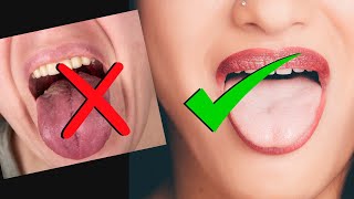 WHAT YOUR TOUNGE SAYS ABOUT YOUR HEALTH