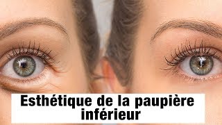 Esthétique de la paupière inférieur