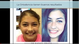 Antes y después de la ortodoncia