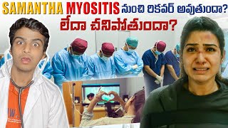 Will Samantha Recover From Myositis or Die? | Top Interesting Facts In Telugu | Facts | Telugu Dost