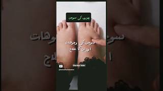 Pairon Ki Sujan: Asbab Aur Ghareloo Totke #Swollen Feet Causes & Remedies #ytshortsvideo