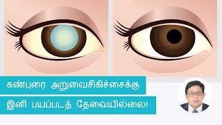 கண்புரை அறுவைசிகிச்சைக்கு இனி பயப்படத் தேவையில்லை!| Tamil