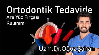 Uzm.Dr.Oğuz Şahan - Ortodontik tedavide ara yüz fırçası nasıl kullanılmalı? Diş telleri temizliği?