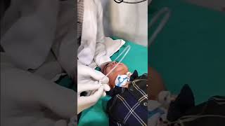 Ryles tube insertion in tracheostomy patient...#Ryles tube #suction #doctor #mbbsmotivation #medicos