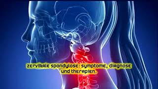 Zervikale Spondylose: Symptome, Diagnose und Therapien