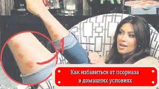 Псориаз. Как избавиться от псориаза в домашних условиях?