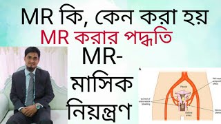 MR (Menstruation Regulation) - এম আর কি, কেন করা হয় ? MR করার পদ্ধতি