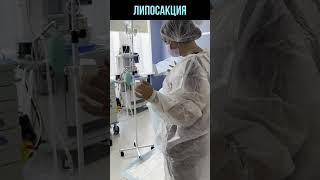 Липосакция | В операционной | Доктор Василенко #shorts