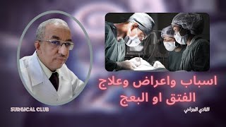 اسباب واعراض وعلاج الفتق او البعج /عملية الفتاق inguinal hernia