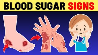 15 Alarming Signs Your Blood Sugar Is Dangerously High - Diabetes Symptoms (Don't Ignore) | VisitJoy