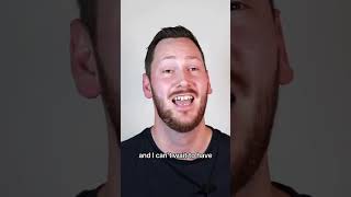 Connor's Smile Makeover - Gum Lift and Upper and Lower Porcelain Veneers