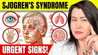 10 Alarming Sjogren's Syndrome Symptoms You Should Know