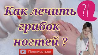 Грибок ногтей | Как лечить грибок | Экзодерил | Лоцерил