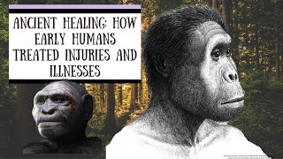 Ancient Healing: How Early Humans Treated Injuries and Illnesses #history #facts #ancestralmedicine